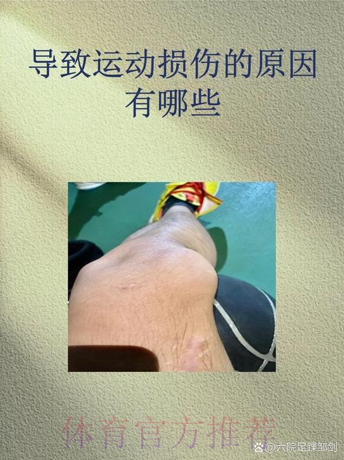 预计伤缺2个月！阿诺德左腿股四头肌前直肌受伤
